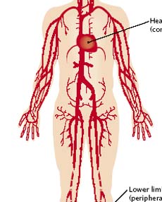 Les pathologies cardio-vasculaires